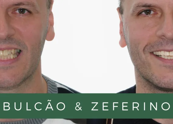 A utilização de imagens “antes e depois” pode configurar promessa de resultado