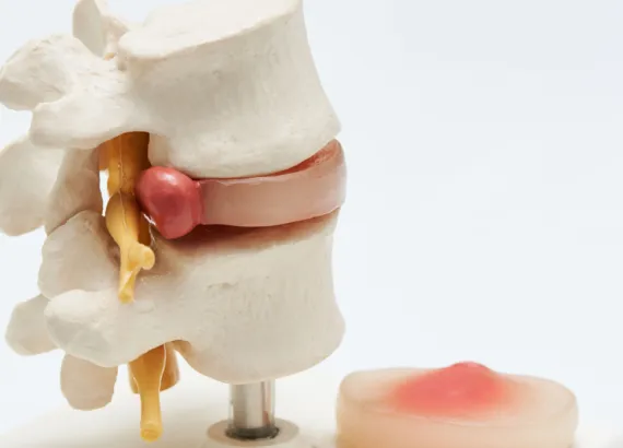 Plano condenado em cirurgia por falha no dever de informar.