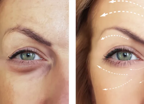 Antes e depois: afinal o médico pode postar?